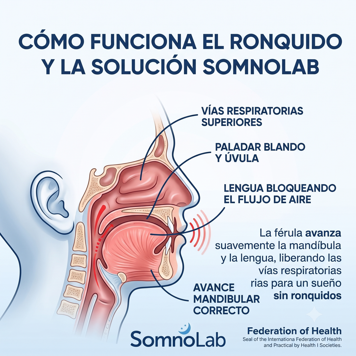 bucal 2  – Di adiós a los ronquidos desde la primera noche con nuestra férula + DOBLE REGALO HOY (Pack Tiras Nasales + Parches Melatonina)